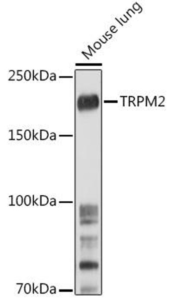 Cell Biology Antibodies 10 Anti-TRPM2 Antibody CAB6137