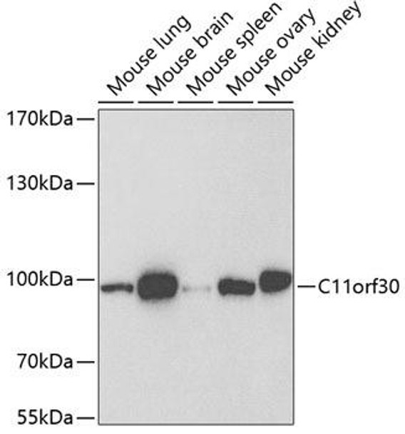 Epigenetics and Nuclear Signaling Antibodies 2 Anti-C11orf30 Antibody CAB6138