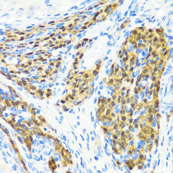 Cell Cycle Antibodies 1 Anti-KMT2E Antibody CAB6142