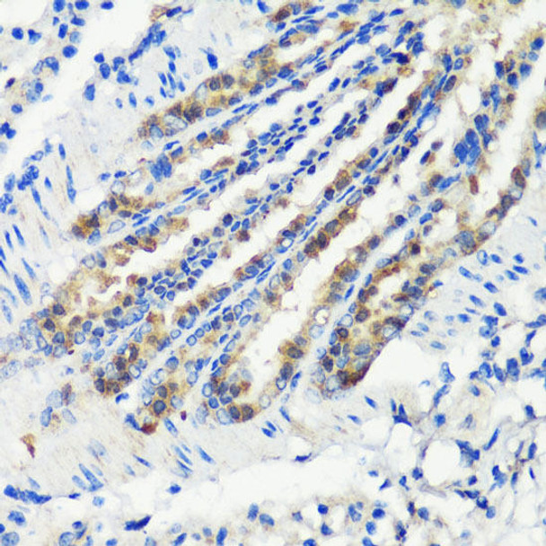 Cell Cycle Antibodies 1 Anti-KMT2E Antibody CAB6142