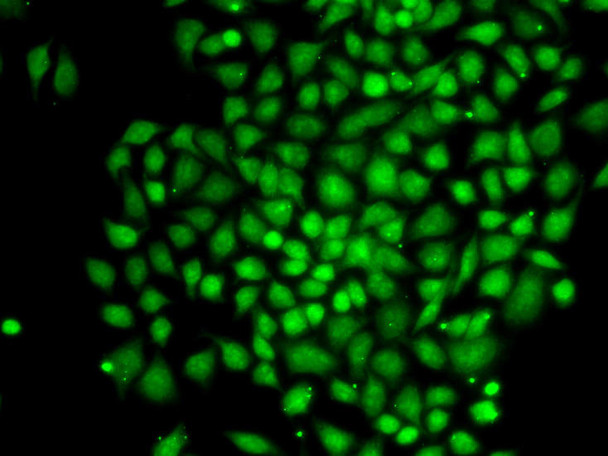 Cell Cycle Antibodies 1 Anti-CTCFL Antibody CAB6149