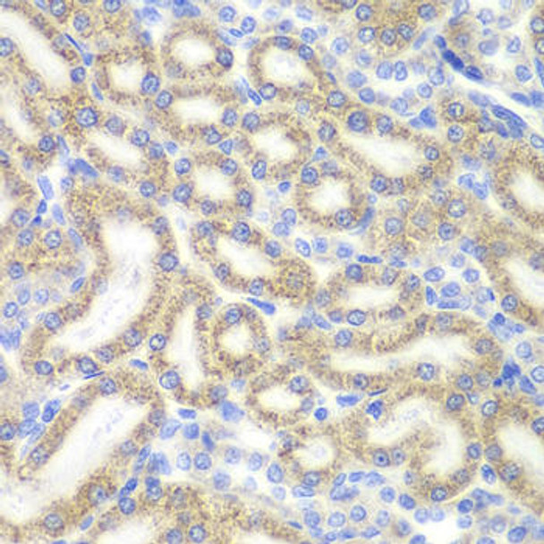 Cell Death Antibodies 2 Anti-DAP Antibody CAB6150