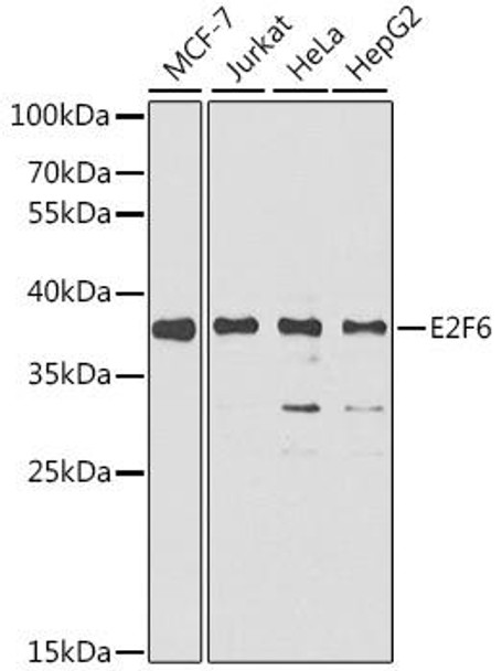 Cell Cycle Antibodies 1 Anti-E2F6 Antibody CAB6151