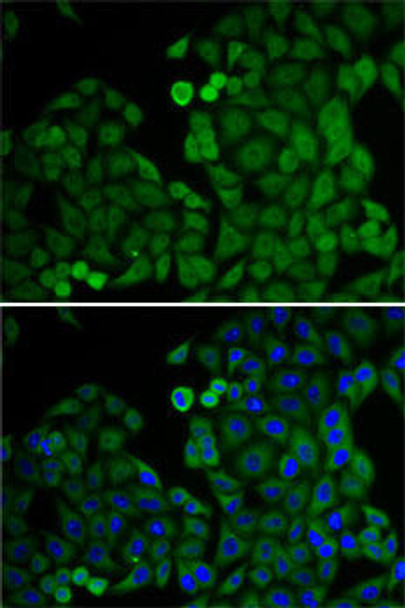 Cell Cycle Antibodies 1 Anti-E2F6 Antibody CAB6151