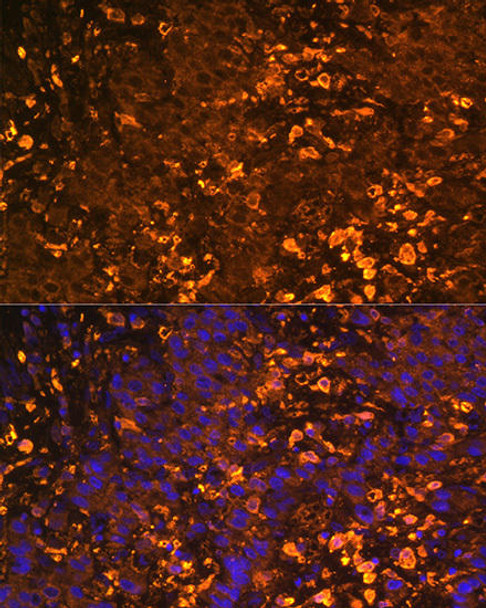 Cell Biology Antibodies 10 Anti-UGT1A1 Antibody CAB6186