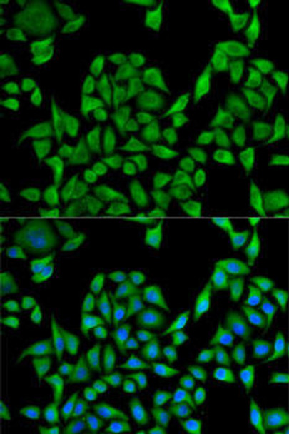 Cell Biology Antibodies 10 Anti-UGT1A1 Antibody CAB6186