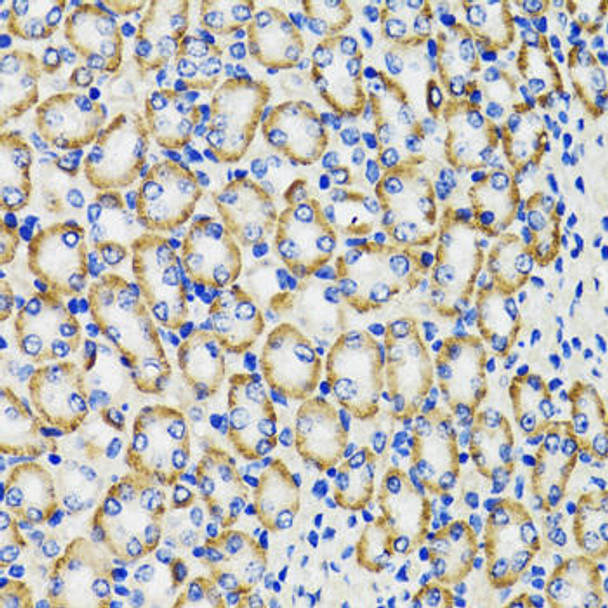 Metabolism Antibodies 2 Anti-COMT Antibody CAB6200