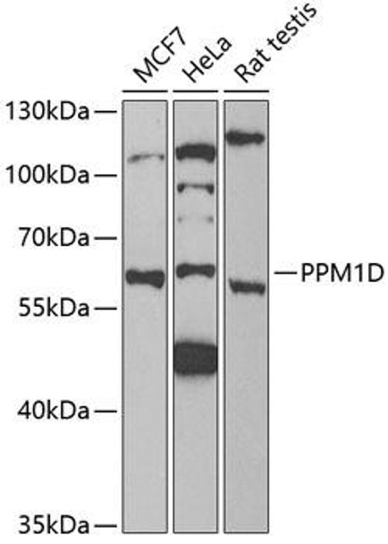 Cell Cycle Antibodies 1 Anti-PPM1D Antibody CAB6204