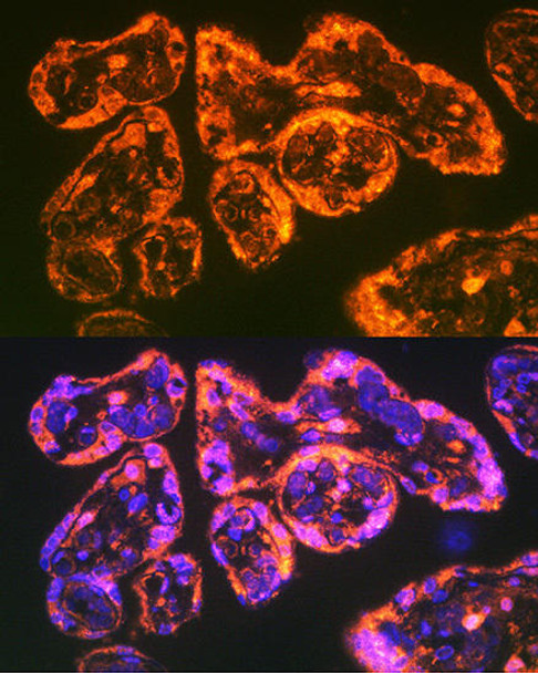 Cell Biology Antibodies 10 Anti-ITGA5 Antibody CAB6209