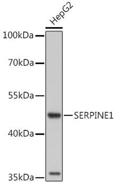 Cell Biology Antibodies 10 Anti-SERPINE1 Antibody CAB6211