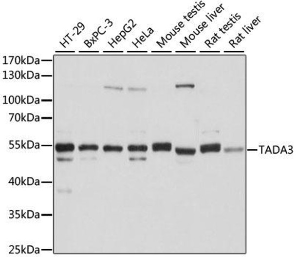 Epigenetics and Nuclear Signaling Antibodies 2 Anti-TADA3 Antibody CAB6224