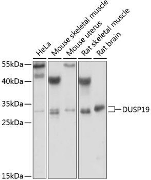 Cell Biology Antibodies 10 Anti-DUSP19 Antibody CAB6227