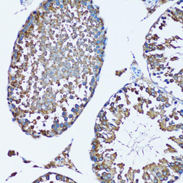 Metabolism Antibodies 2 Anti-SQS/FDFT1 Antibody CAB6229