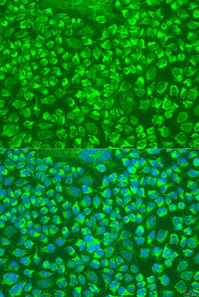 Cell Death Antibodies 2 Anti-GZMA Antibody CAB6231