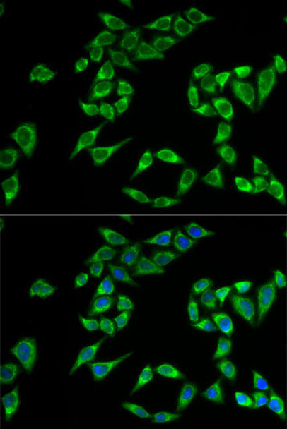 Cell Biology Antibodies 10 Anti-PHLDA2 Antibody CAB6244