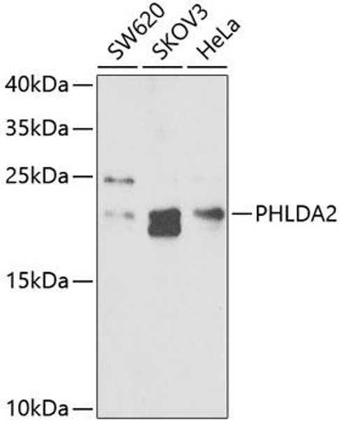 Cell Biology Antibodies 10 Anti-PHLDA2 Antibody CAB6244