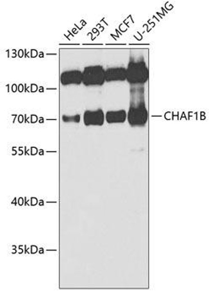 Cell Cycle Antibodies 1 Anti-CHAF1B Antibody CAB6259