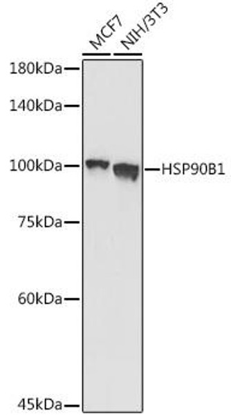 Cell Biology Antibodies 10 Anti-HSP90B1 Antibody CAB6272