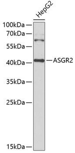 Cell Biology Antibodies 10 Anti-ASGR2 Antibody CAB6281