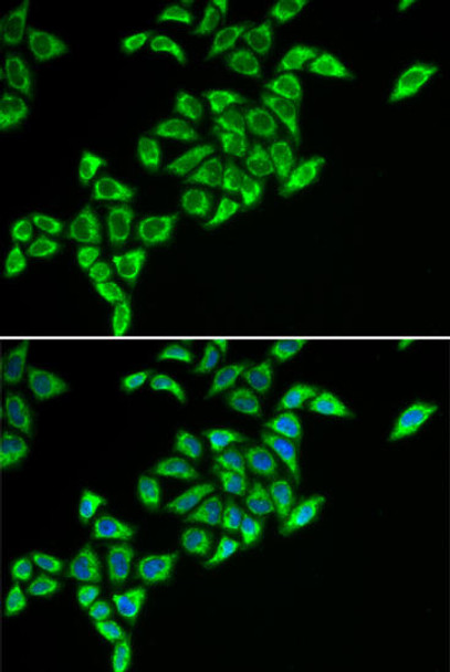 Metabolism Antibodies 2 Anti-DLAT Antibody CAB6288