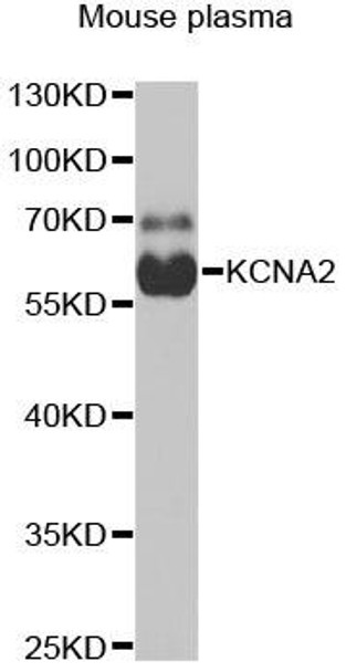 Signal Transduction Antibodies 3 Anti-KCNA2 Antibody CAB6295