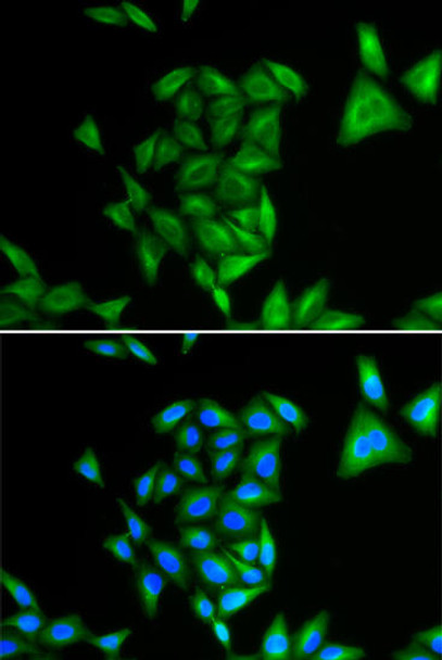 Cell Biology Antibodies 10 Anti-PHYH Antibody CAB6304