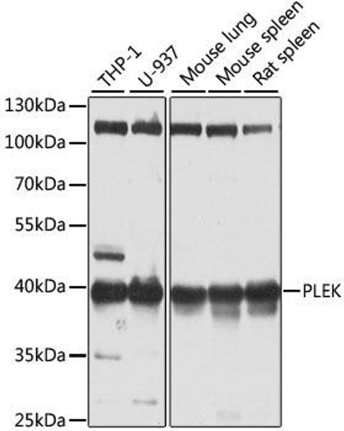 Cell Biology Antibodies 10 Anti-PLEK Antibody CAB6305