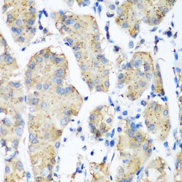 Cell Biology Antibodies 10 Anti-PLEK Antibody CAB6305