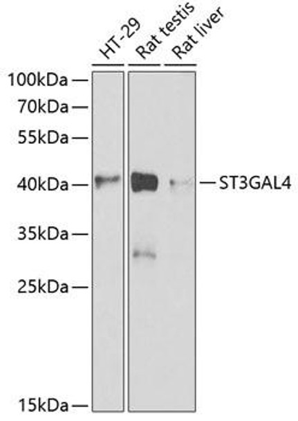 Cell Biology Antibodies 10 Anti-ST3GAL4 Antibody CAB6309