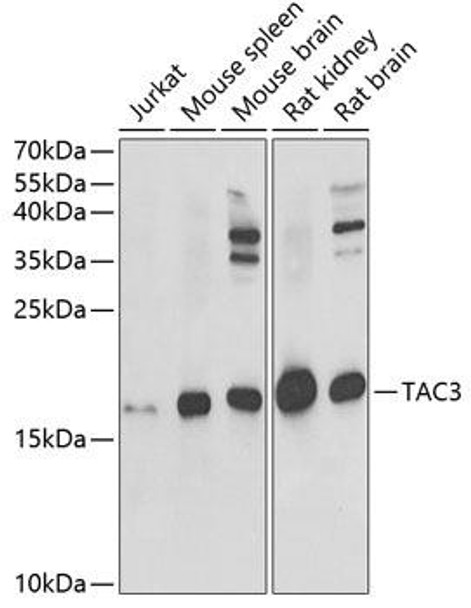 Cell Biology Antibodies 10 Anti-TAC3 Antibody CAB6312