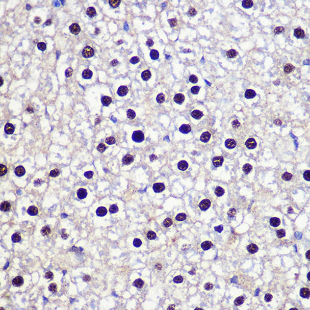 Cell Biology Antibodies 10 Anti-TKT Antibody CAB6314