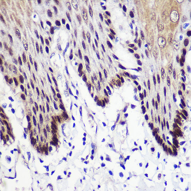 Cell Biology Antibodies 10 Anti-TKT Antibody CAB6314