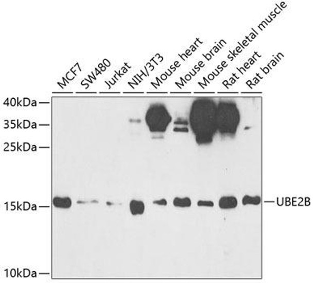Epigenetics and Nuclear Signaling Antibodies 2 Anti-UBE2B Antibody CAB6315