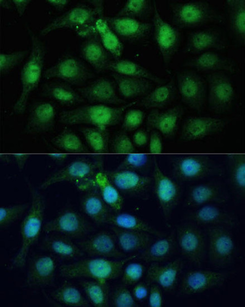 Cell Cycle Antibodies 1 Anti-ZWINT Antibody CAB6328