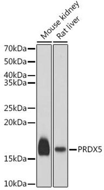 Cell Biology Antibodies 10 Anti-PRDX5 Antibody CAB6329