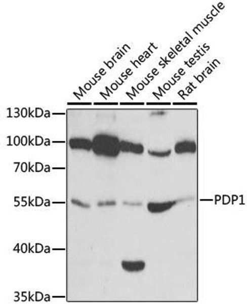 Cell Biology Antibodies 10 Anti-PDP1 Antibody CAB6332