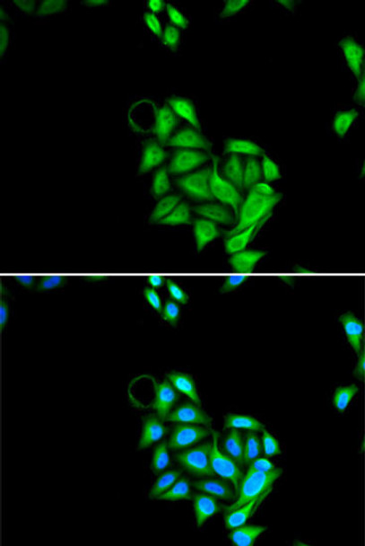 Cell Death Antibodies 2 Anti-JADE1 Antibody CAB6337