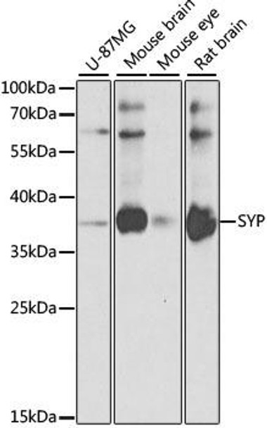 Cell Biology Antibodies 10 Anti-SYP Antibody CAB6344