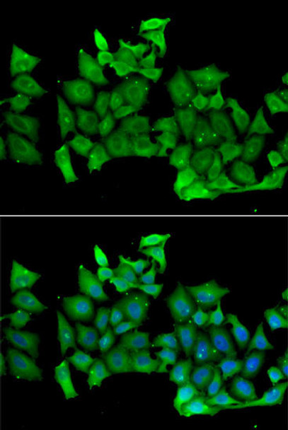 Cell Biology Antibodies 10 Anti-RHOH Antibody CAB6356