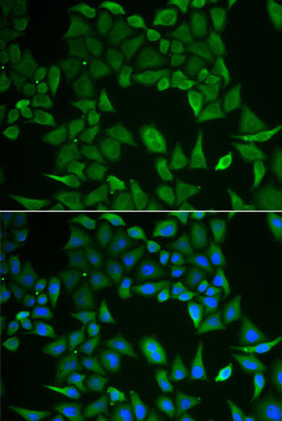 Cell Biology Antibodies 10 Anti-CLPS Antibody CAB6364