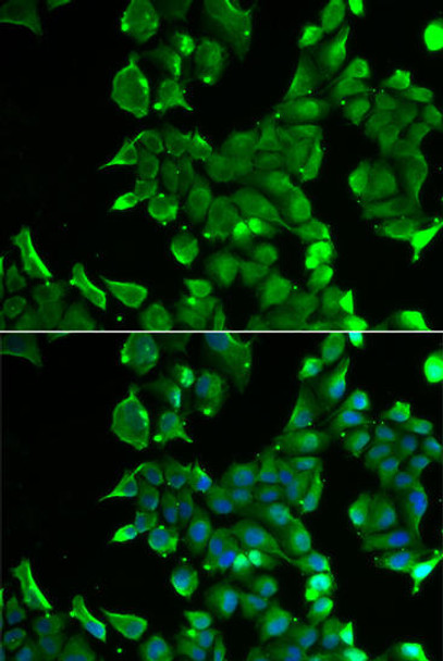 Cell Biology Antibodies 10 Anti-STOM Antibody CAB6372