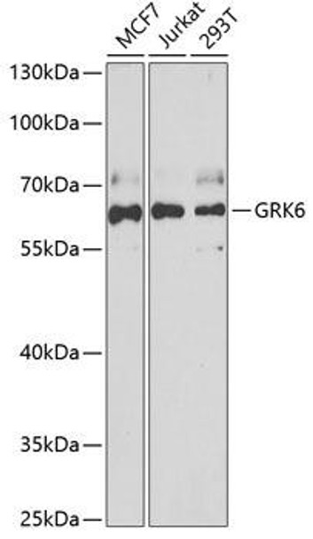 Metabolism Antibodies 2 Anti-GRK6 Antibody CAB6379