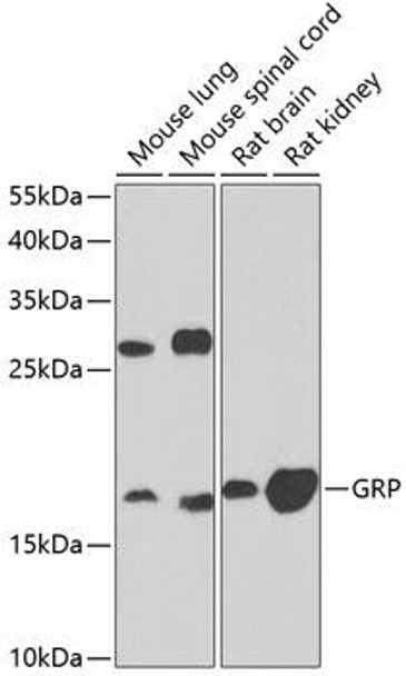 Cell Biology Antibodies 10 Anti-GRP Antibody CAB6380