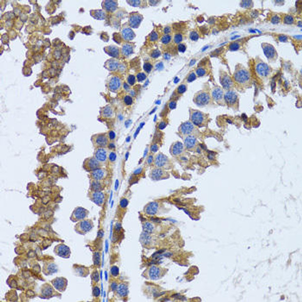 Cell Biology Antibodies 10 Anti-IMPA1 Antibody CAB6381