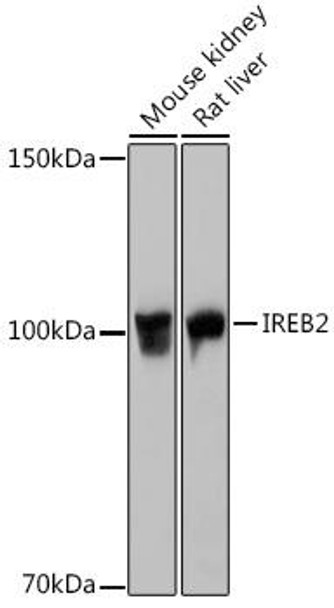 Cardiovascular Antibodies Anti-IREB2 Antibody CAB6382