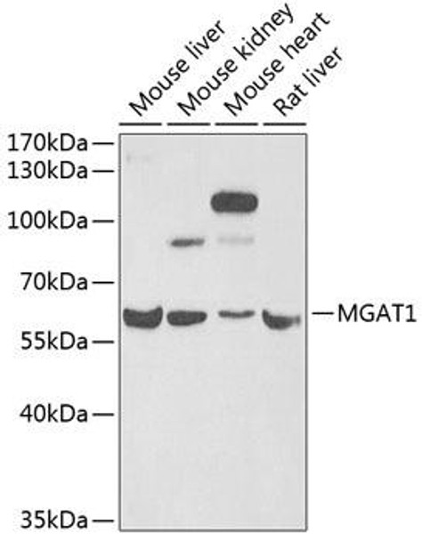 Cell Biology Antibodies 10 Anti-MGAT1 Antibody CAB6387