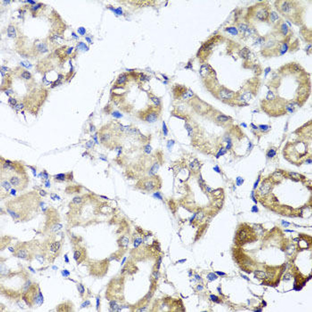 Cell Biology Antibodies 10 Anti-MGAT1 Antibody CAB6387