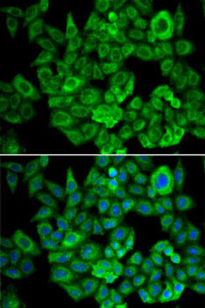 Metabolism Antibodies 2 Anti-OGDH Antibody CAB6391