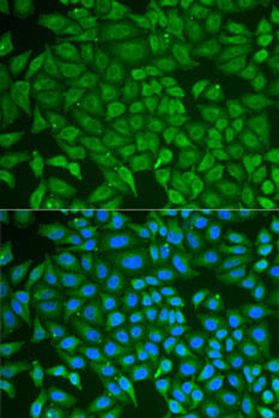 Cell Biology Antibodies 10 Anti-PIP Antibody CAB6394