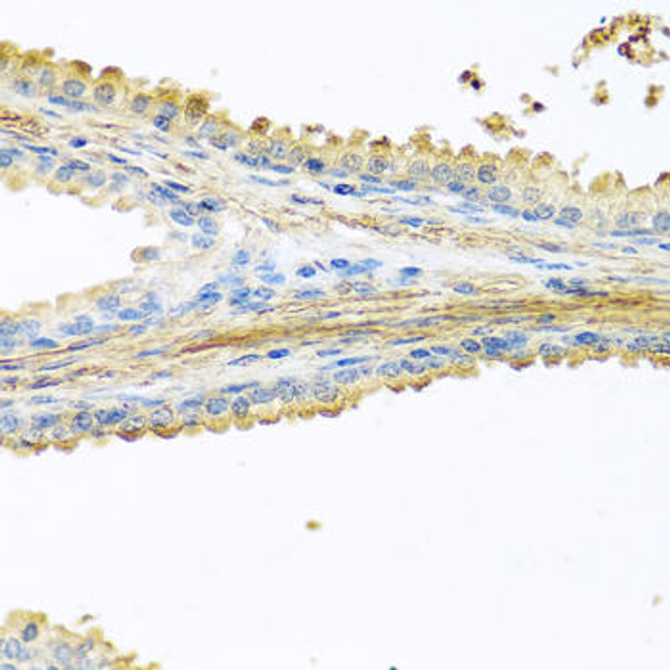 Cell Biology Antibodies 10 Anti-PIP Antibody CAB6394